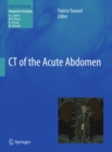 CT of the Acute Abdomen - eBook