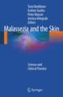 Malassezia and the Skin : Science and Clinical Practice - eBook