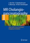 MR Cholangiopancreatography : Atlas with Cross-Sectional Imaging Correlation - Book