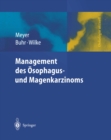 Management des Magen- und Osophaguskarzinoms - eBook