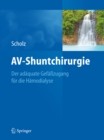 AV-Shuntchirurgie : Der adaquate Gefazugang fur die Hamodialyse - eBook