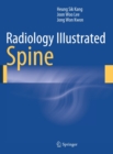 Radiology Illustrated: Spine - eBook