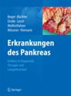 Erkrankungen des Pankreas : Evidenz in Diagnostik, Therapie und Langzeitverlauf - eBook
