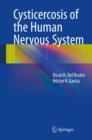 Cysticercosis of the Human Nervous System - eBook