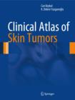 Clinical Atlas of Skin Tumors - Book