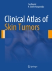 Clinical Atlas of Skin Tumors - eBook