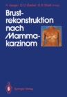 Brustrekonstruktion nach Mammakarzinom - eBook