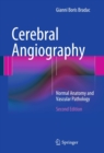 Cerebral Angiography : Normal Anatomy and Vascular Pathology - eBook