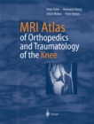 MRI Atlas of Orthopedics and Traumatology of the Knee - eBook