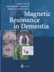 Magnetic Resonance in Dementia - eBook