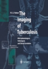The Imaging of Tuberculosis : With Epidemiological, Pathological, and Clinical Correlation - eBook