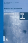 Osteoporose - eBook