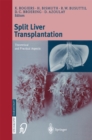 Split liver transplantation : Theoretical and practical aspects - eBook
