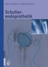 Schulterendoprothetik : Indikation, Implantate, OP-Technik, Nachbehandlung, Begutachtung - eBook