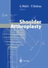 Shoulder Arthroplasty - eBook