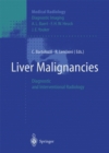 Liver Malignancies : Diagnostic and Interventional Radiology - eBook