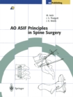 AO ASIF Principles in Spine Surgery - eBook
