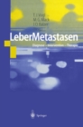 LeberMetastasen : Diagnose - Intervention - Therapie - eBook