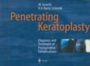 Penetrating Keratoplasty : Diagnosis and Treatment of Postoperative Complications - eBook