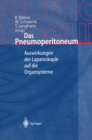 Das Pneumoperitoneum : Auswirkungen der Laparoskopie auf die Organsysteme - eBook