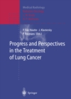Progress and Perspective in the Treatment of Lung Cancer - eBook
