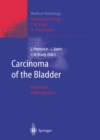 Carcinoma of the Bladder : Innovations in Management - eBook