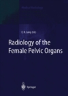 Radiology of the Female Pelvic Organs - eBook