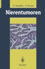 Nierentumoren : Grundlagen, Diagnostik, Therapie - eBook
