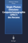 Single-Photon-Emissions-Computertomographie (SPECT) des Herzens - eBook