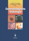 Dermatologische Onkologie - eBook