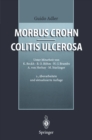 Morbus Crohn - Colitis ulcerosa - eBook