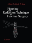 Planning and Reduction Technique in Fracture Surgery - eBook
