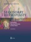Secondary Rhinoplasty : Including Reconstruction of the Nose - Book