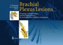 Brachial Plexus Lesions : Drawings of Explorations and Reconstructions by Algimantas Otonas Narakas - Book