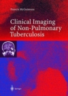 Clinical Imaging in Non-Pulmonary Tuberculosis - Book