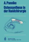 Osteosynthese in der Handchirurgie - Book