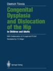 Congenital Dysplasia and Dislocation of the Hip in Children and Adults - Book