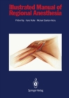 Illustrated Manual of Regional Anesthesia : Conception, Realization, Consultation, Organization: Bureaux Bassler, Karlsruhe, FRG Artist: Wolfgang Rost, Graphic-Design - eBook