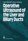 Operative Ultrasound of the Liver and Biliary Ducts - eBook