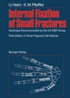 Internal Fixation of Small Fractures : Technique Recommended by the AO-ASIF Group - eBook