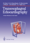 Transesophageal Echocardiography : A New Window to the Heart - eBook