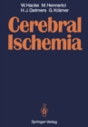 Cerebral Ischemia - eBook