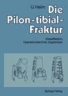 Die Pilon-tibial-Fraktur : Klassifikation, Operationstechnik, Ergebnisse - eBook
