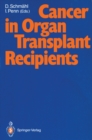 Cancer in Organ Transplant Recipients - eBook