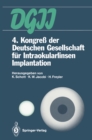 4. Kongre der Deutschen Gesellschaft fur Intraokularlinsen Implantation : 6. bis 7. April 1990, Essen - eBook