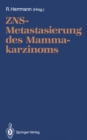ZNS-Metastasierung des Mammakarzinoms - eBook