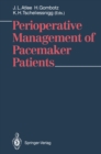 Perioperative Management of Pacemaker Patients - eBook