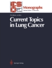 Current Topics in Lung Cancer - eBook
