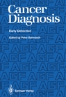 Cancer Diagnosis : Early Detection - eBook