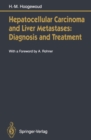 Hepatocellular Carcinoma and Liver Metastases: Diagnosis and Treatment - eBook